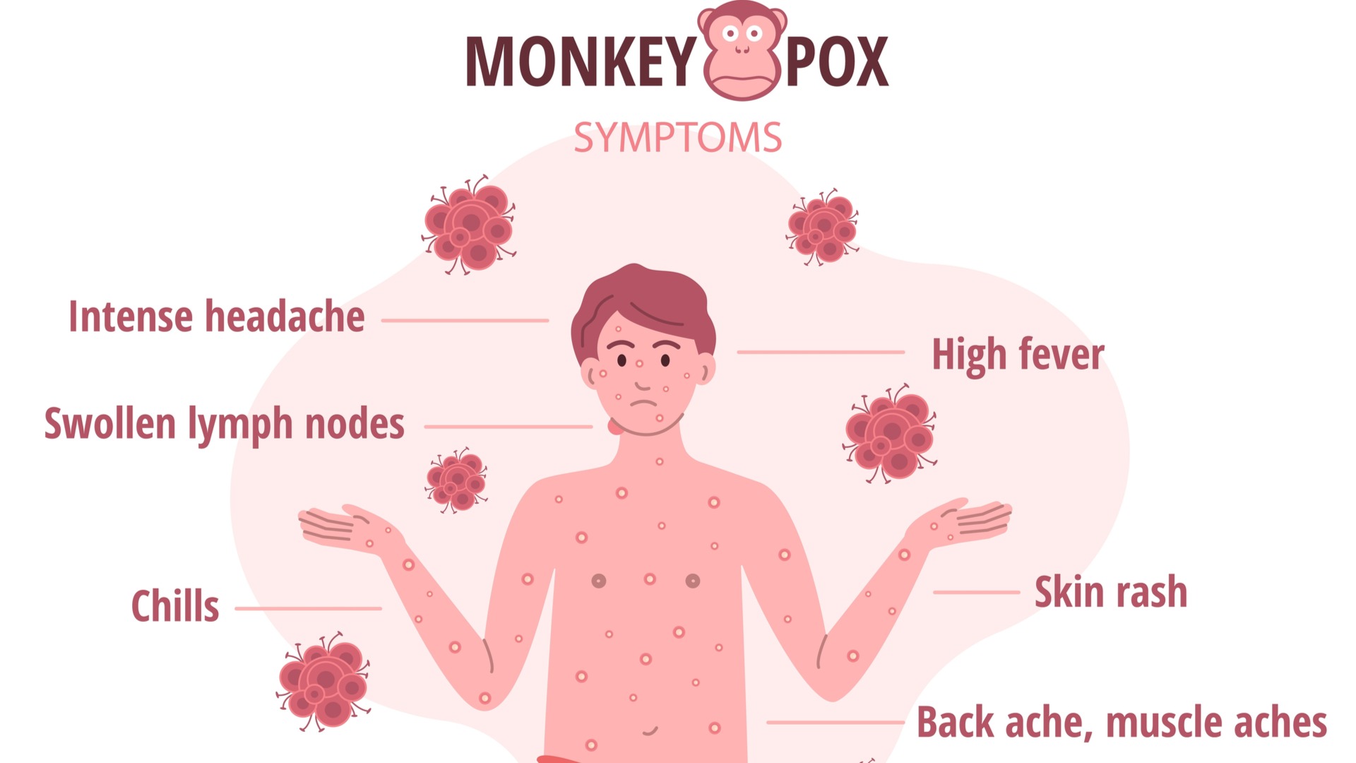 symptomer ved apekopper